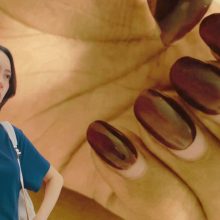 ¿Mi uña se movió o creció?”